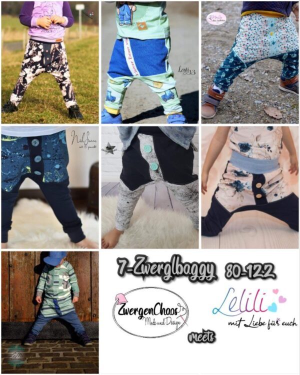 EBOOK 7-Zwerglbaggy Part 1 – Bild 1