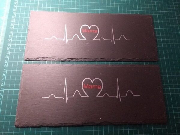 EKG sinus mit  Herz – Bild 3