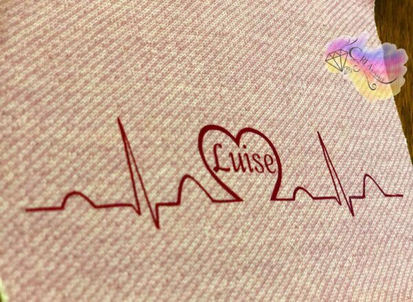 EKG sinus mit  Herz – Bild 1